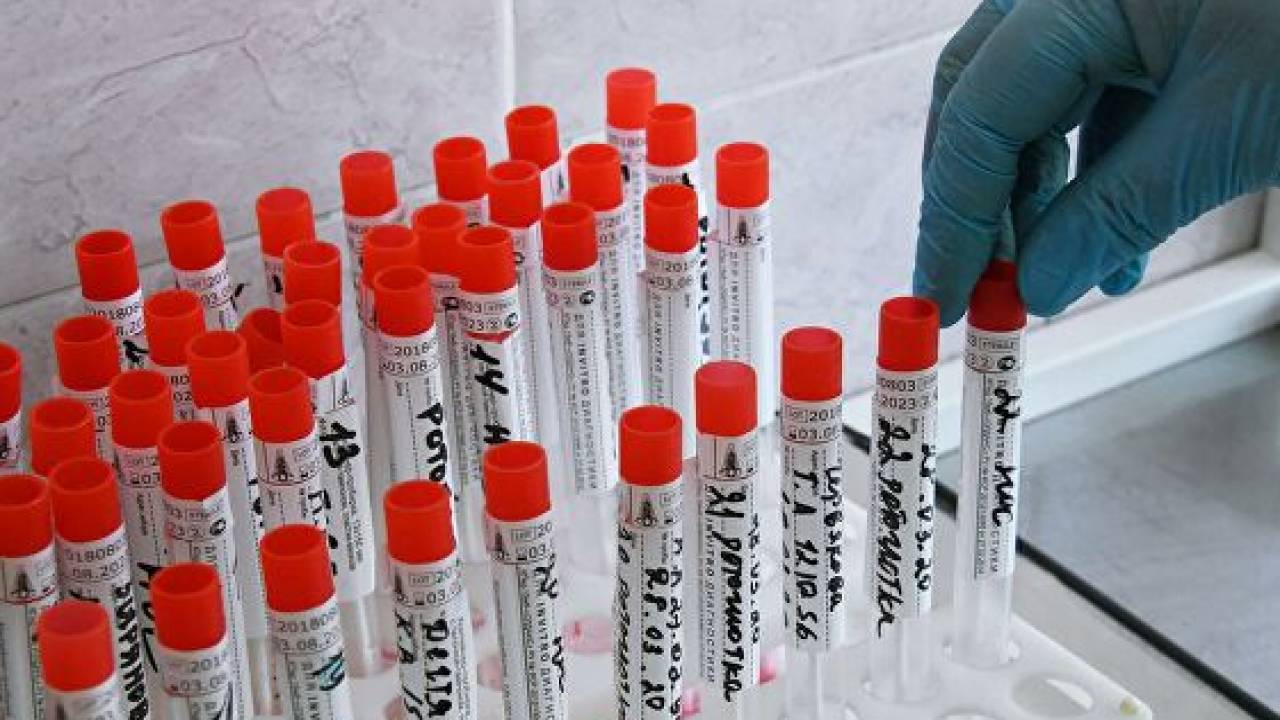 Число заболевших коронавирусом в Казахстане превысило 170 тысяч