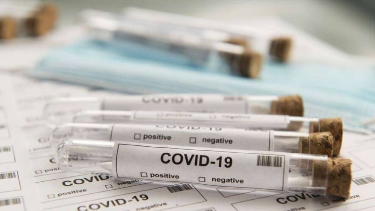 Еще 1 228 казахстанцев заразились за сутки COVID-19
