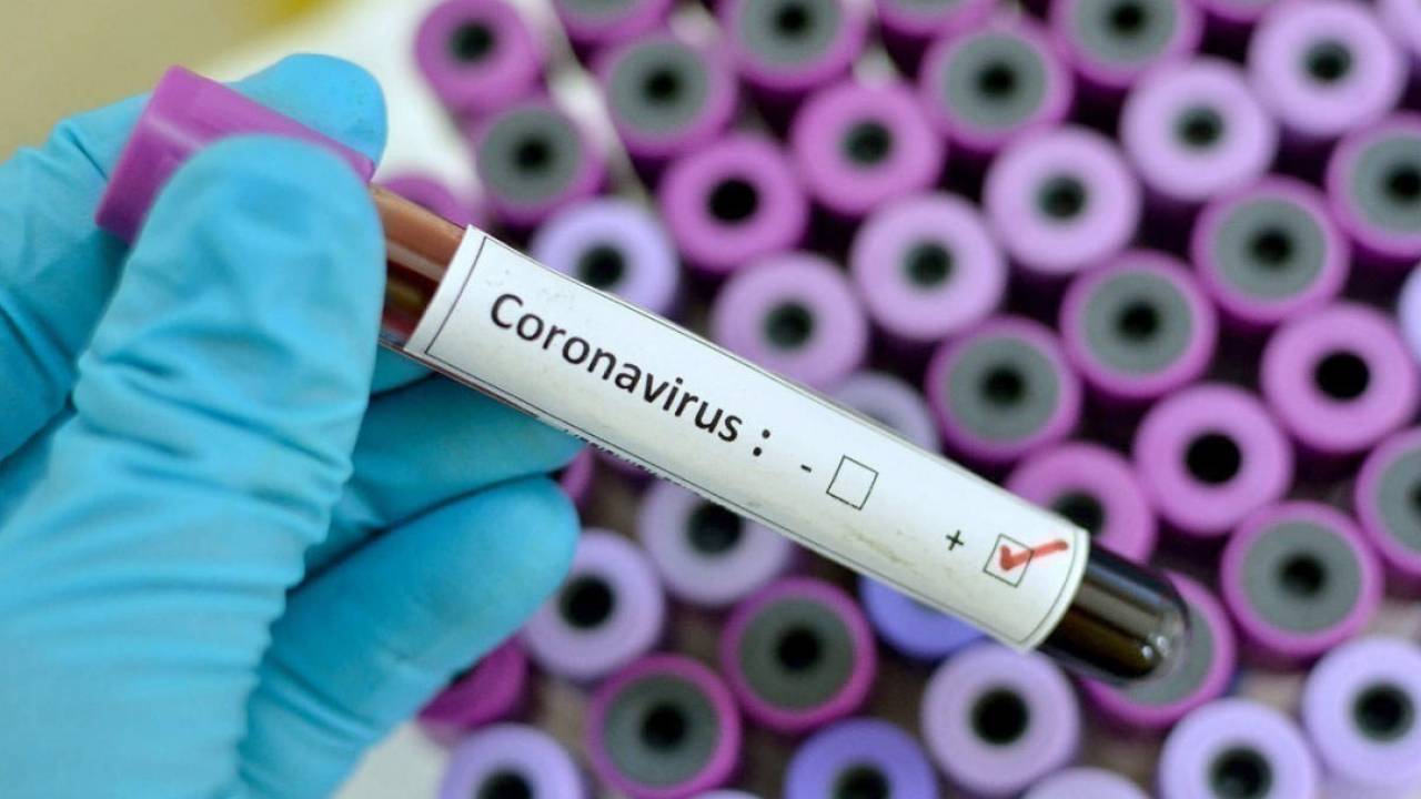Еще 28 человек скончались от коронавируса и пневмонии в Казахстане