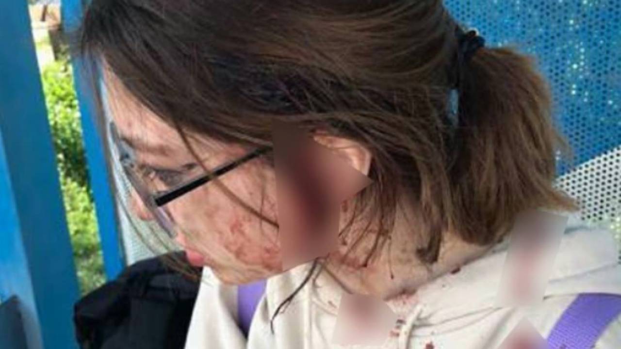 Подростка жестоко избили две женщины в Алматинской области