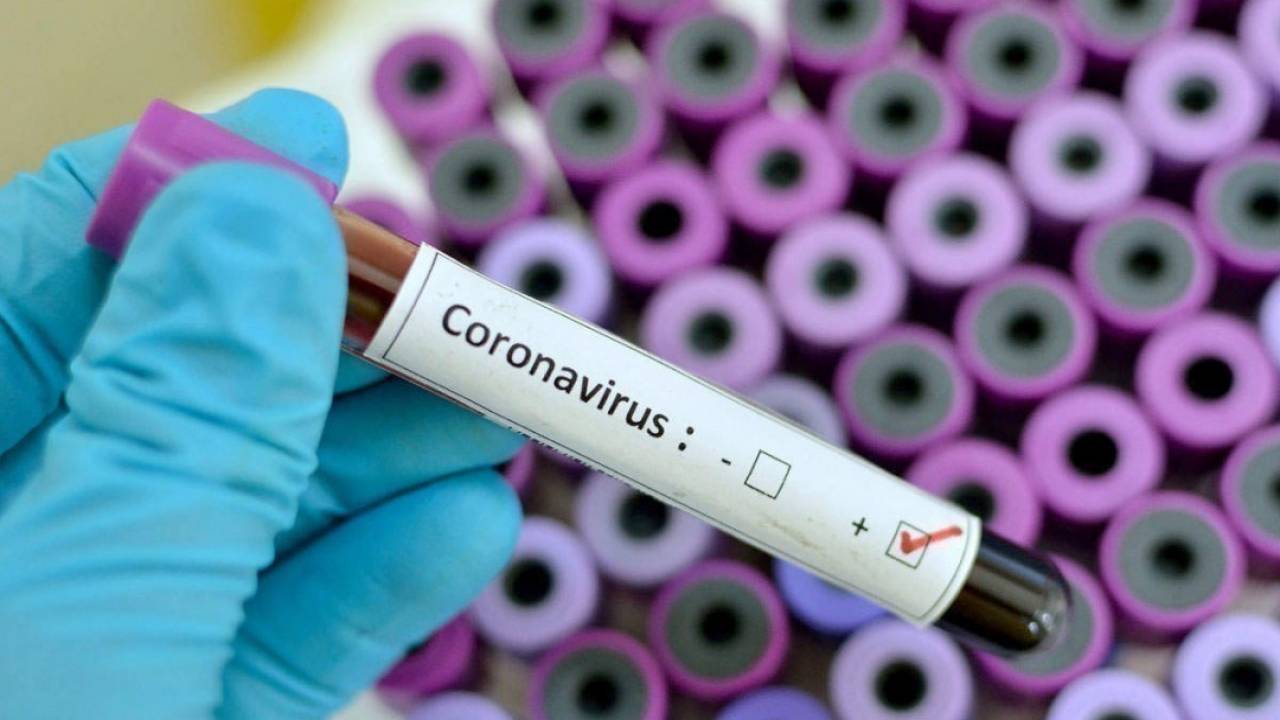 Сколько новых случаев коронавируса выявили в Казахстане за 17 мая