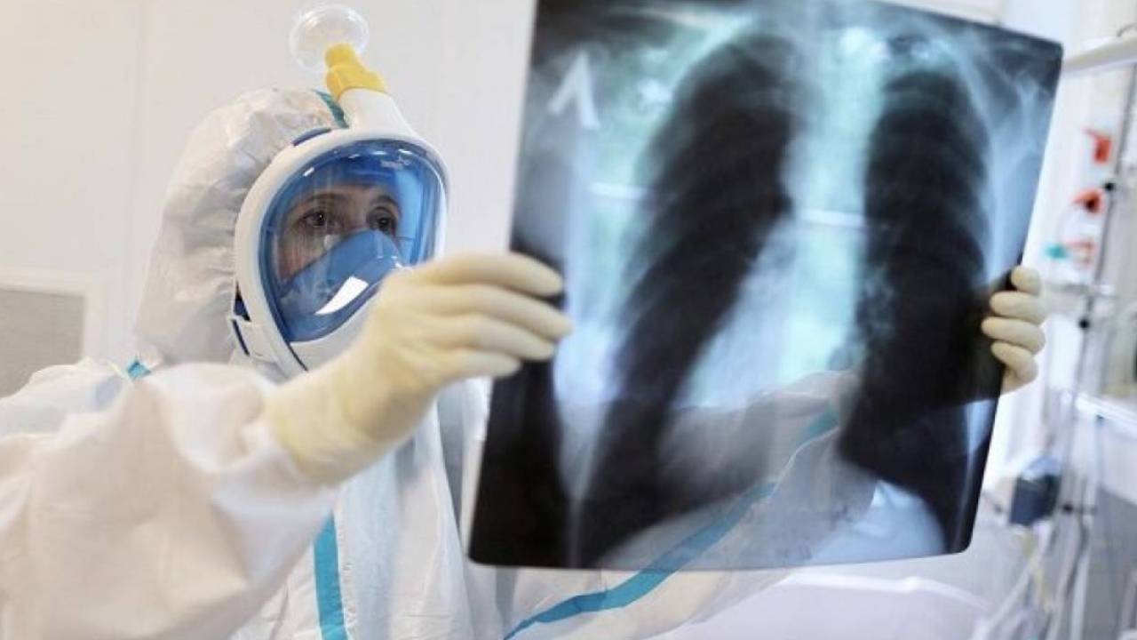 В Казахстане от коронавирусной пневмонии умерло гораздо больше